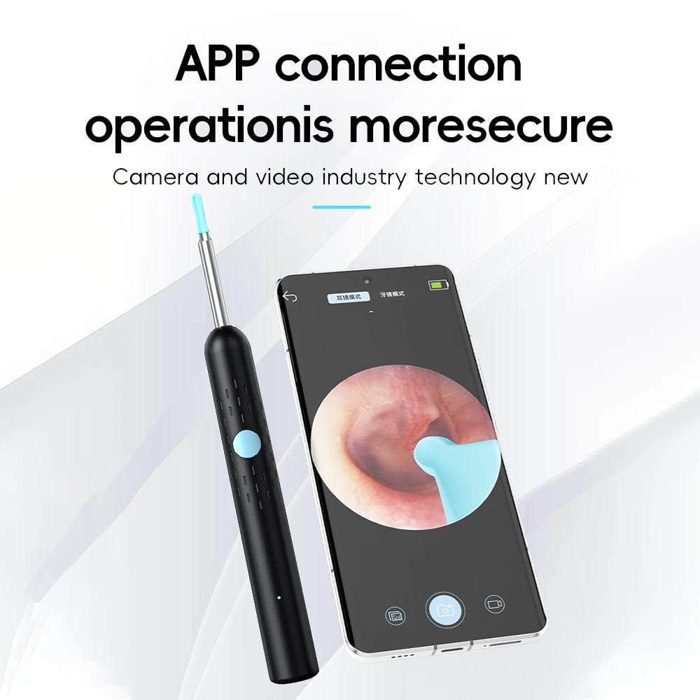Visual Ear Cleaner Ear Wax Removal Tool with Camera Wireless Visual Ear Pick Otoscope for Adults Kids Rechargeable Home Use Peaceful Pleasures Health and Wellness