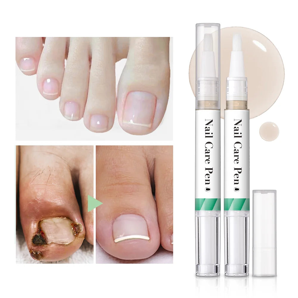 Nail Growth Oil Nail Treatment Cuticle Revitalizer Oil Prevent Agnail Nail Polish Nail Nutrition Oil Pen Manicure Nail Repair Peaceful Pleasures Health and Wellness