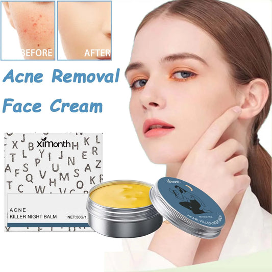 Acne Removal Face Cream – Oil Control, Pore Shrinking & Hydrating Peaceful Pleasures Health and Wellness