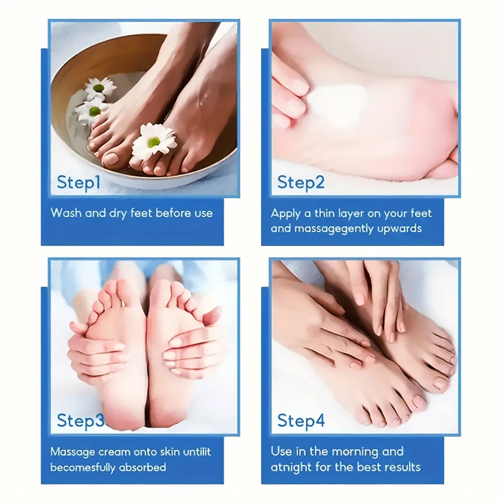 Urea Hand 42% and Foot Cream Softens Moisturizes Skin Relieves Dryness Repairs Cracks Exfoliates Deeply Penetrates Foot Cream Peaceful Pleasures Health and Wellness
