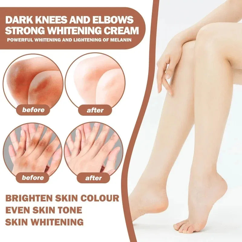 Dark Knuckles Whitening Serum Remover Get Rid of Dark Knees Dark Knuckle Elbow Cream Moisturizing Brighten Skin Tone Care Peaceful Pleasures Health and Wellness