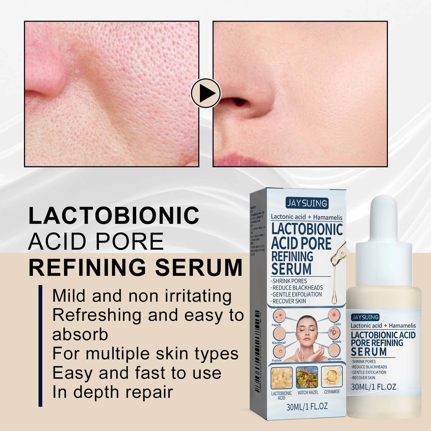 Lactic Acid Essence – Blackhead Removal & Pore Tightening Serum