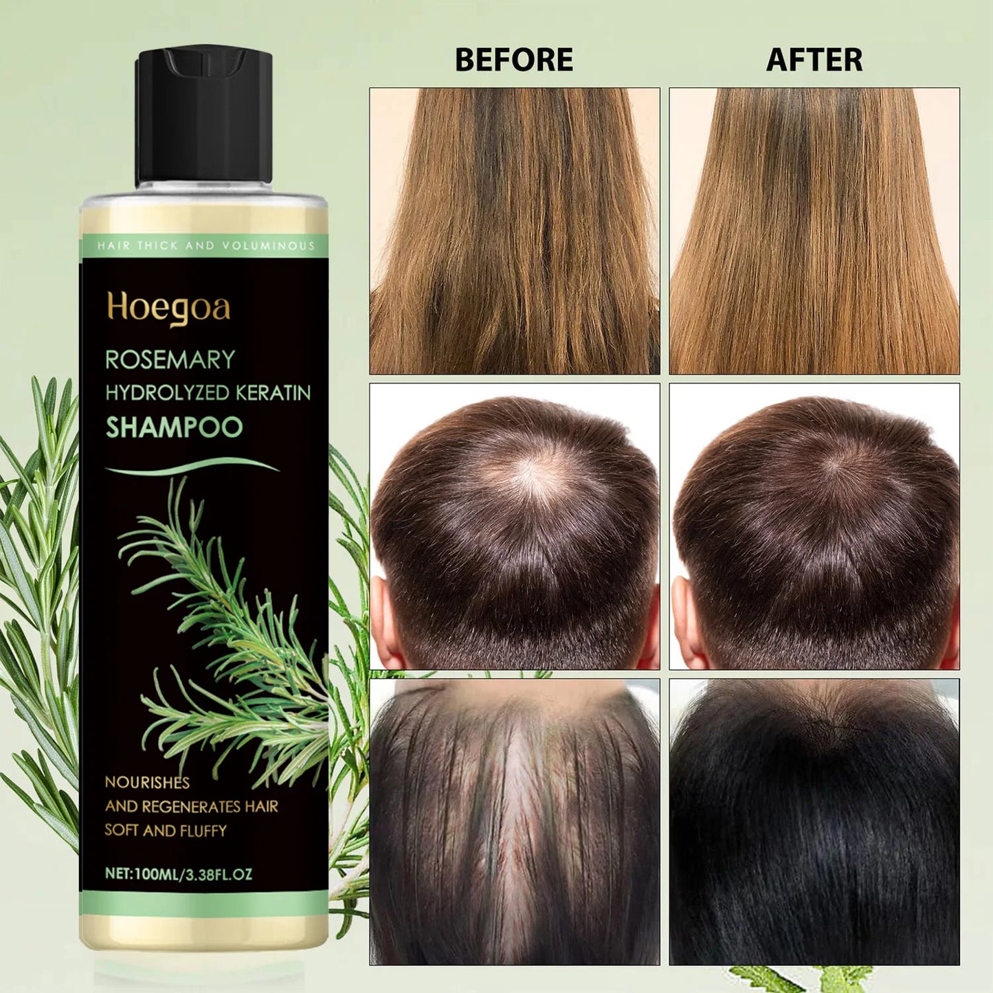 HOEGOA Rosemary Oil Shampoo for Hair Growth & Thinning