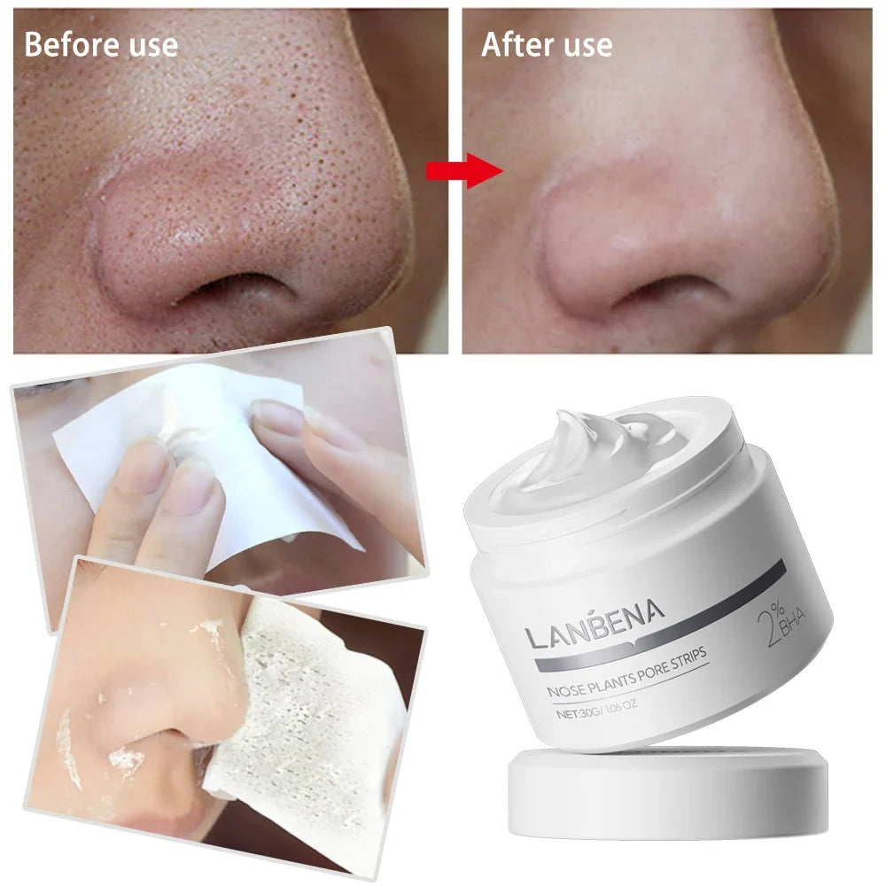 LANBENA Blackhead Remover Nose Mask – Deep Cleanse 60 Strips