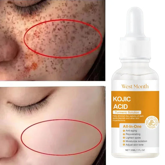 Kojic Acid Brightening Serum – Dark Spot & Tone Corrector Brightening Face Serum Oasis Select