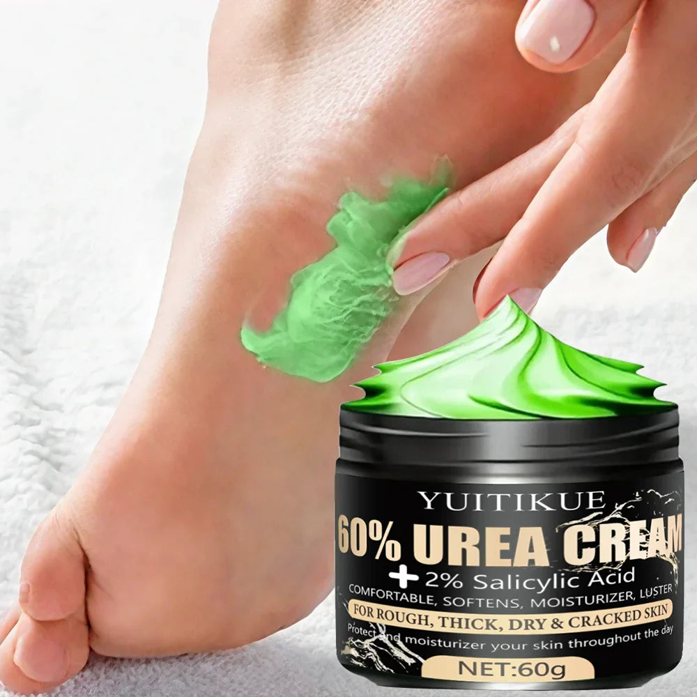 YUITIKUE Urea Cream 60g – Heels, Dry Hands & Rough Skin
