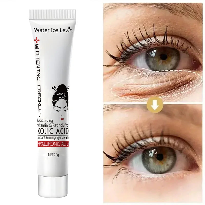 Kojic Acid Eye Cream – Dark Circles, Bags & Firming