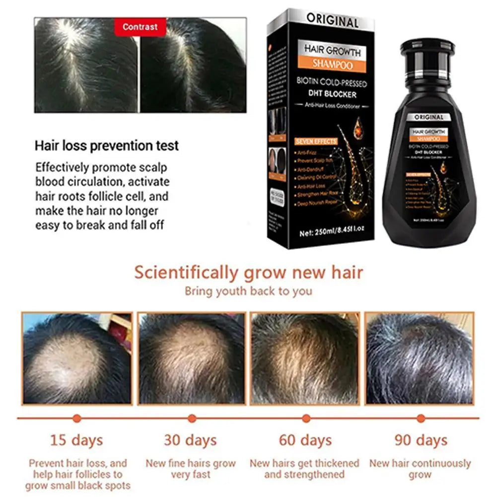 Ginger Hair Growth Shampoo – Deep Cleanse & Scalp Nourishment