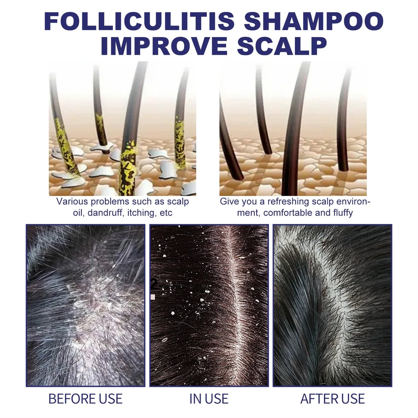 HOEGOA Deep Scalp Cleansing Shampoo – Dandruff & Hair Care