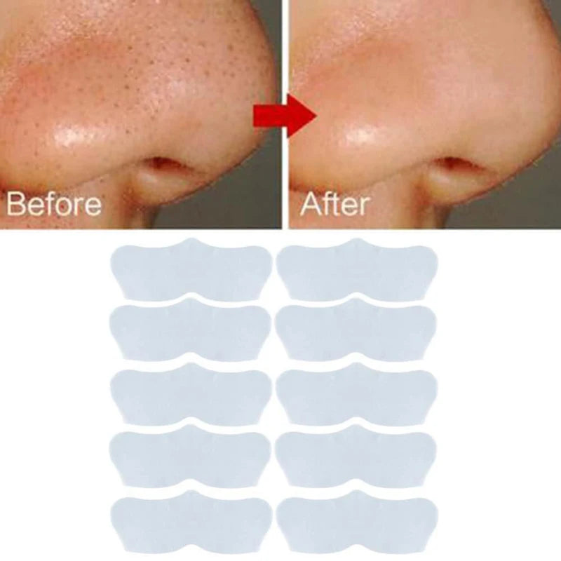 10-100PC Blackhead Remover Mask Nasal Strips Black Head Nose Dot Spot Peel Off Sticker Face Acne Whitehead Pore Cleaner Nose Peaceful Pleasures Health and Wellness