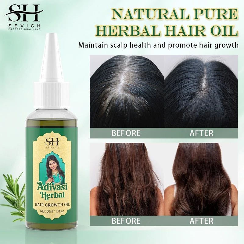 Ayurvedic Hair Growth Oil – Coconut-Based Scalp & Hair Serum (50ml)
