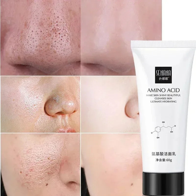 Nicotinamide Amino Acid Face Cleanser Facial Scrub Cleansing Acne Oil Control Blackhead Remover Shrink Pores Skin Care Peaceful Pleasures Health and Wellness