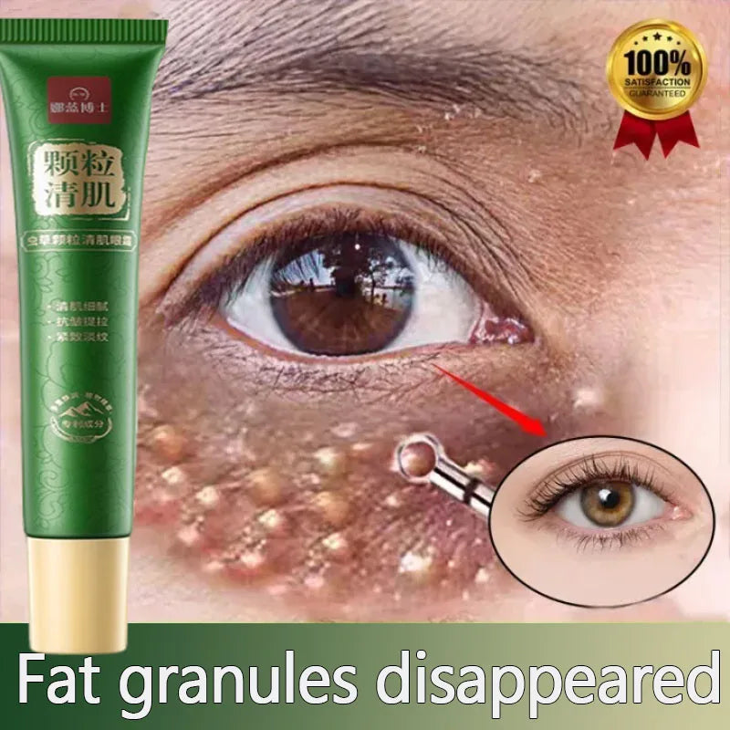 Eye Cream for Dark Circles, Puffiness & Fine Lines – 20g