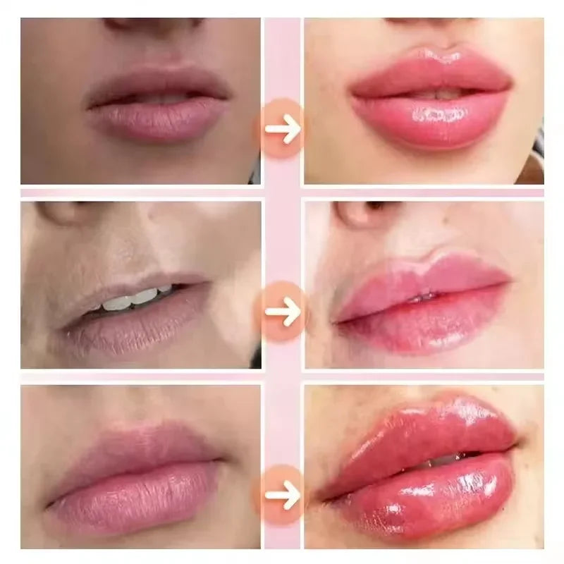 Eelhoe Lip Plumper Serum – Instant Volume & Moisture Gloss