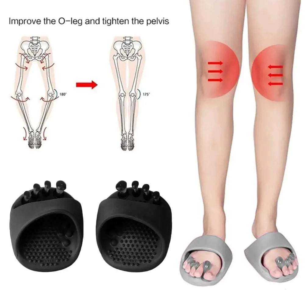 New Adult O X Type Leg Correction Slippers Insoles Bow Leg Valgus Varus Orthotic Device for Men Women Daily Use Daily Correction Peaceful Pleasures Health and Wellness