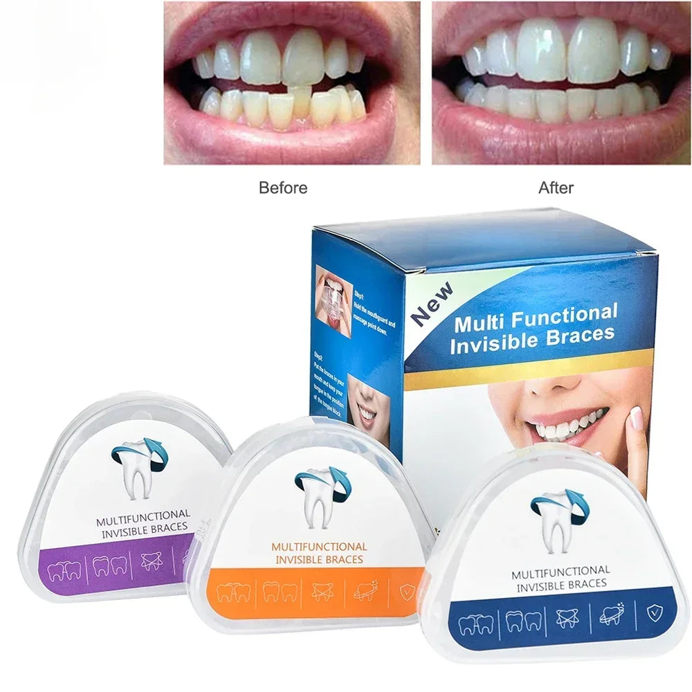 3-Stage Transparent Teeth Aligners - Orthodontic Dental Braces for Adults, DIY Tooth Straightening Corrector Kit Peaceful Pleasures Health and Wellness