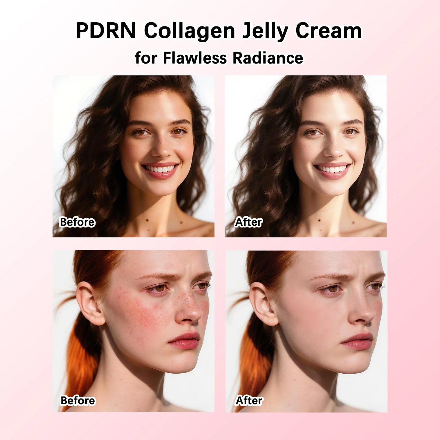 PDRN Collagen Jelly Cream | 7 Collagen Complex Firming Moisturizer
