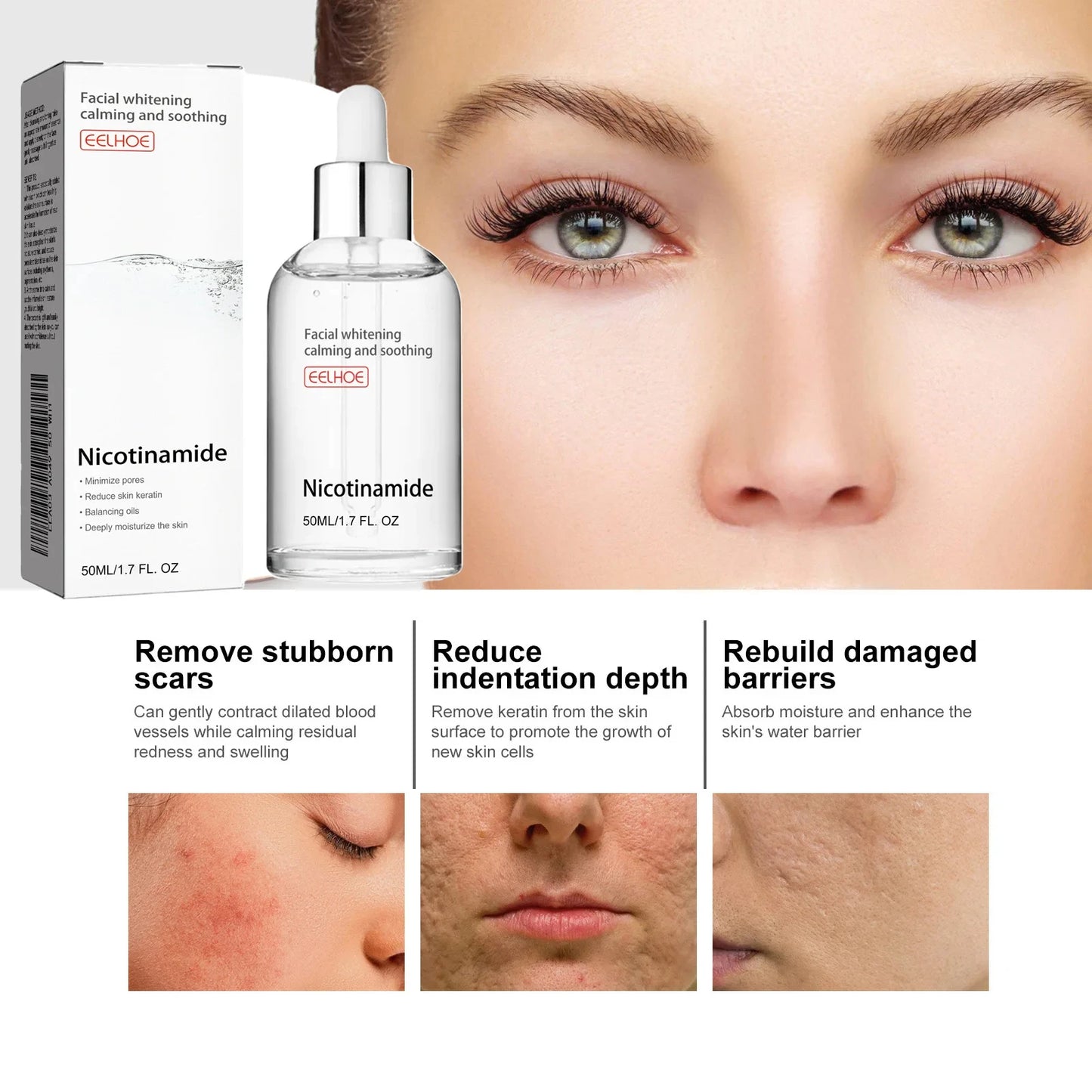 Niacinamide Face Serum – Brighten & Fade Dark Spots 50ml