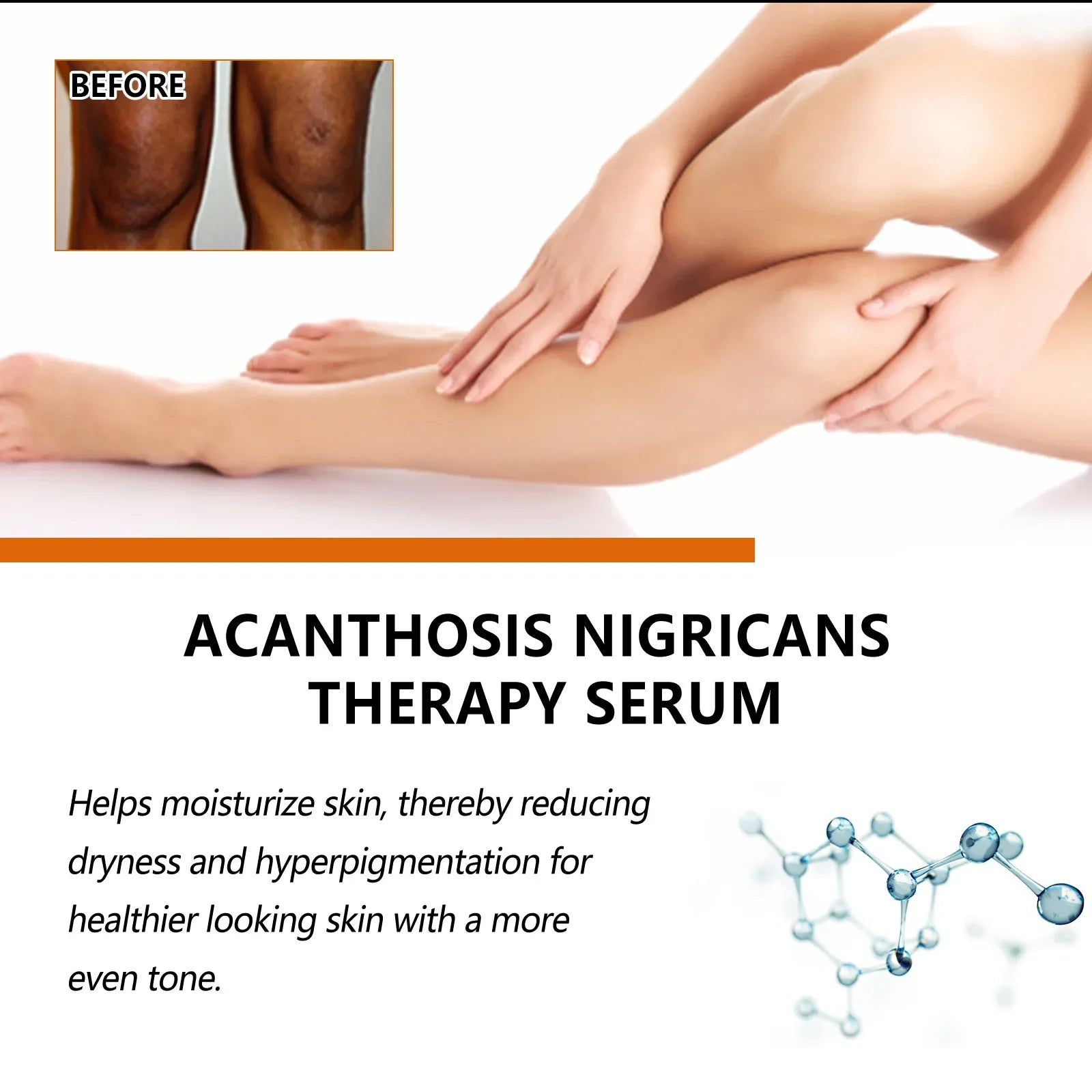 Dark Knuckles Whitening Serum Dark Knees Elbow Lightening Pigmentation Corrector Hand Knuckle Glow Intense Stains Remover Serum Peaceful Pleasures Health and Wellness