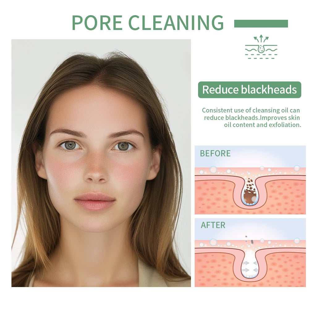 Deeply Cleansing Oil Instant Makeup Removal Refreshing Non Irritating Removal Cleansing Oil Sensitive Skin Care Peaceful Pleasures Health and Wellness