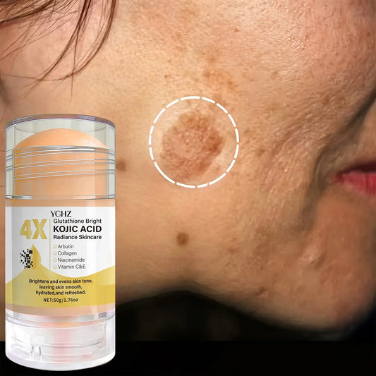 Kojic Acid Cream Stick – Brightening & Even Skin Tone | 50g Brightening Face Cream Oasis Select