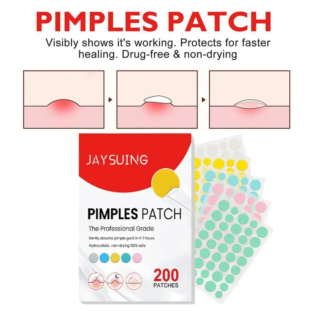 200pcs Hydrocolloid Acne Patch Facial Skin Care Repair Fade Blemishes Pimple Zots Closed Acne Blemishes Cover Acne Pimple Patch Peaceful Pleasures Health and Wellness