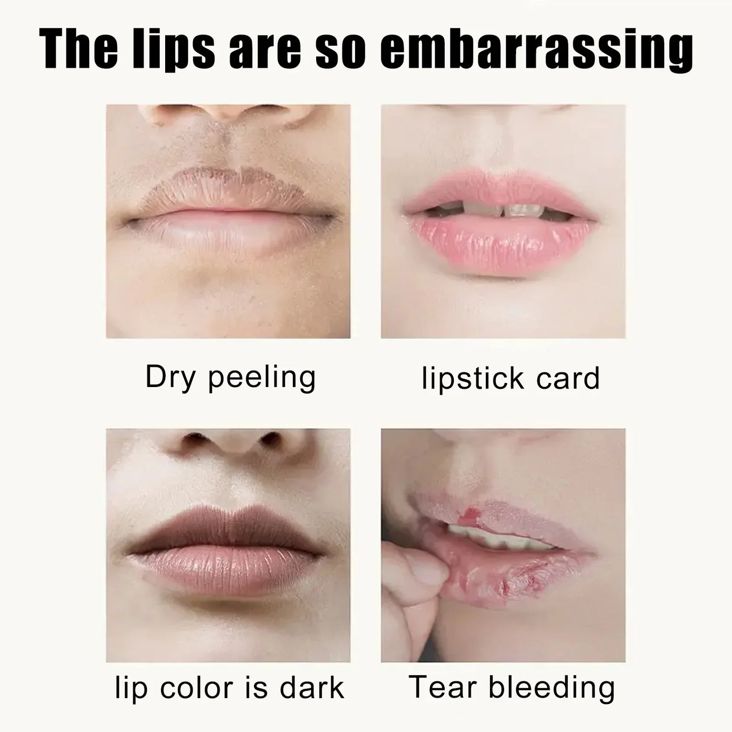 EELHOE Cherry Lip Mask – Moisturize, Fade Lines & Repair (5pk)