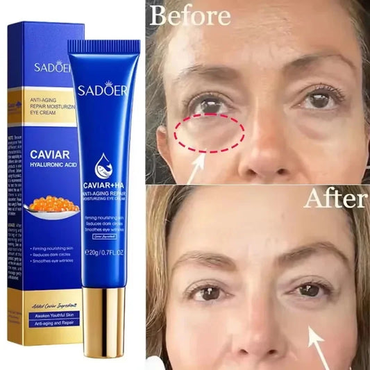 Caviar & Hyaluronic Acid Eye Cream – Firming & Brightening 20g Eye Cream Oasis Select