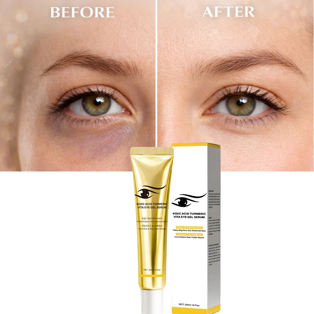 Kojic Acid Turmeric Eye Serum Vitamin C & Caffeine Eye Gel Cream Visibly Brightens Dull Eyes, Fades Dark Circles Eye Care ,30ml Peaceful Pleasures Health and Wellness