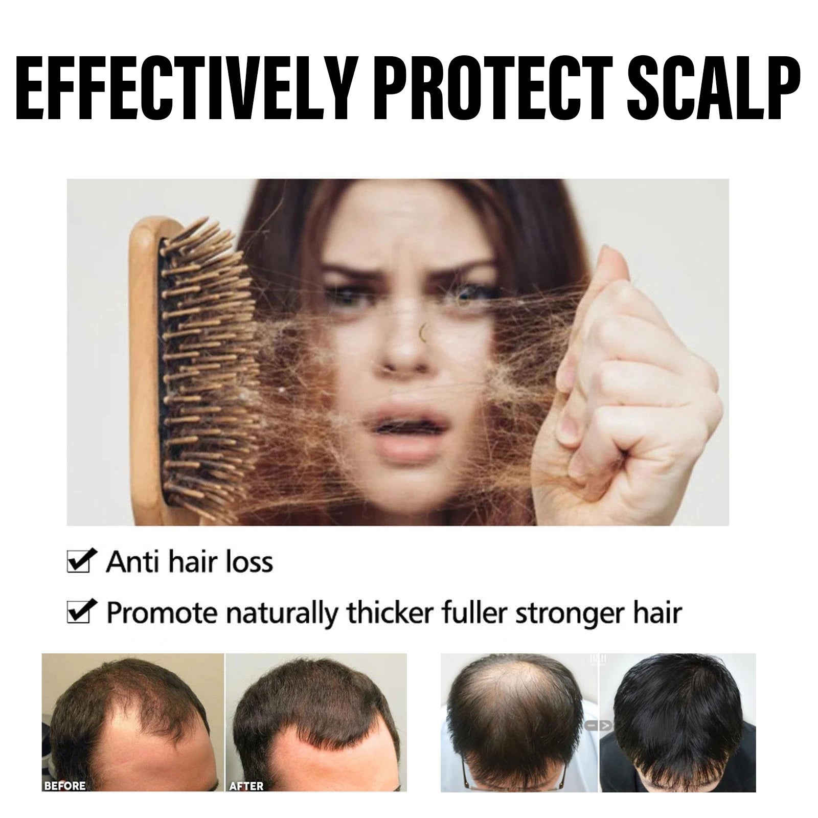 HOEGOA 30PCS Hair Regrowth Capsules Promotes Hair Growth Prevents Hair Loss Nourishes The Scalp Scalp Essential Oil Capsules Peaceful Pleasures Health and Wellness
