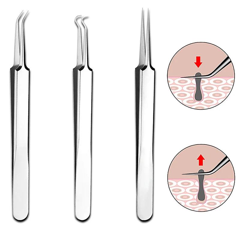1pc 8CM Cell Pimples Blackhead Clip Tweezers Beauty Salon Special Scraping Closing Artifact Needle Tool Peaceful Pleasures Health and Wellness