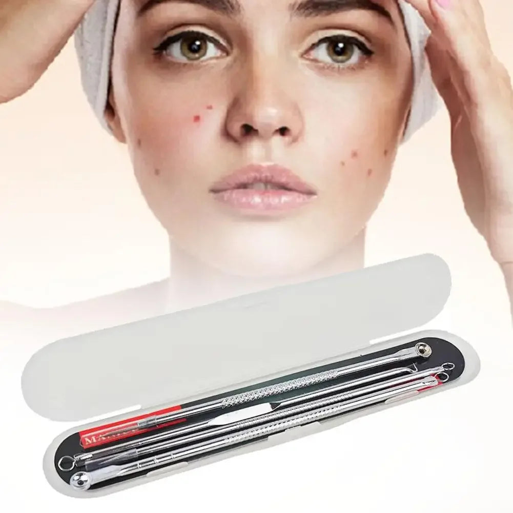 4-Piece Blackhead Remover Tool Set – Stainless Steel Peaceful Pleasures Health and Wellness