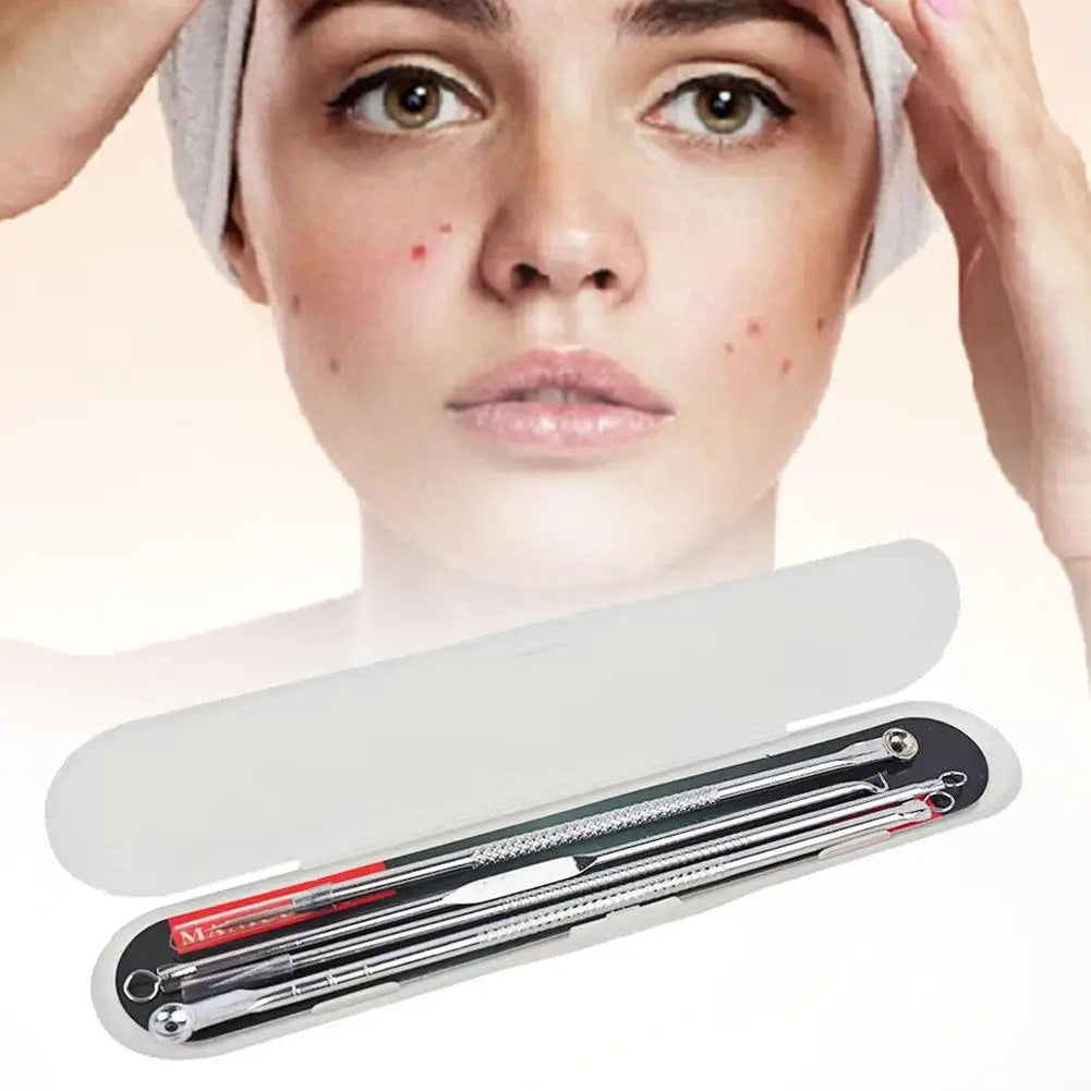 4-Piece Blackhead Remover Tool Set – Stainless Steel Pimple Popper