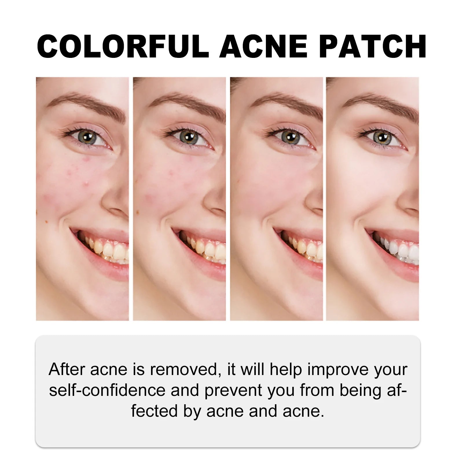Acne Treatment Patch Absorbing Acne Cover Blemish Anti Infection Waterproof Spot Marks Concealer Colorful Pimple Removal Sticker Peaceful Pleasures Health and Wellness