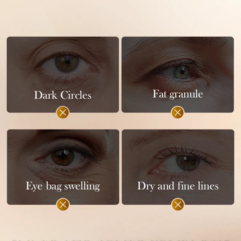 SADOER Snake Venom Peptide Eye Cream – Dark Circles & Wrinkles