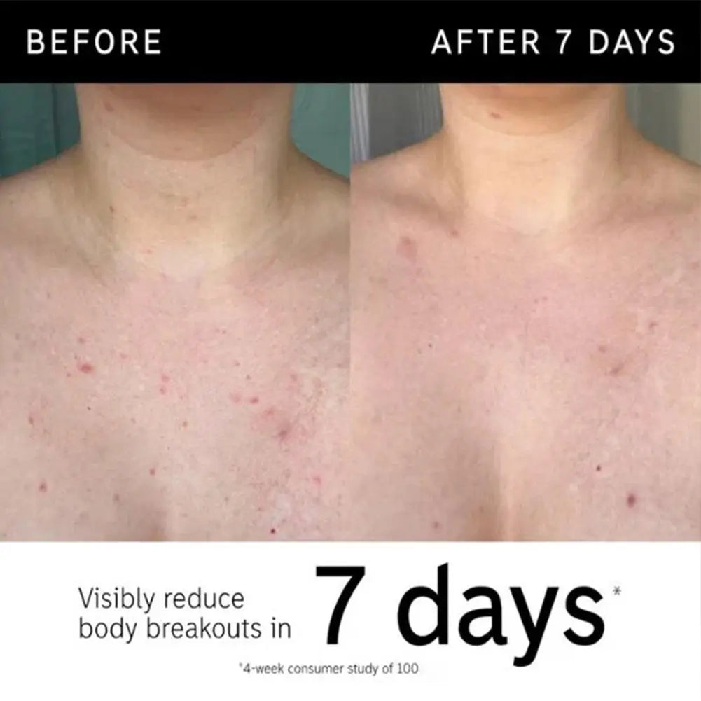 Glycolic Acid Exfoliating Body Stick | Smooth & Brighten Skin