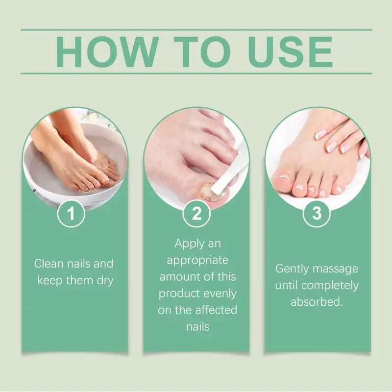 Onychomycosis Pen for Hands and Feet Nourishing and Brightening Nails Thickening Nails and Toe Care Pen Peaceful Pleasures Health and Wellness
