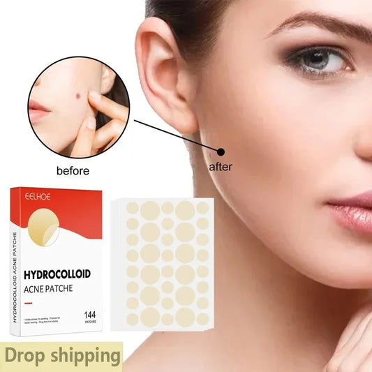 Hydrocolloid Acne Patches – 144pc Invisible Pimple Cover Peaceful Pleasures Health and Wellness