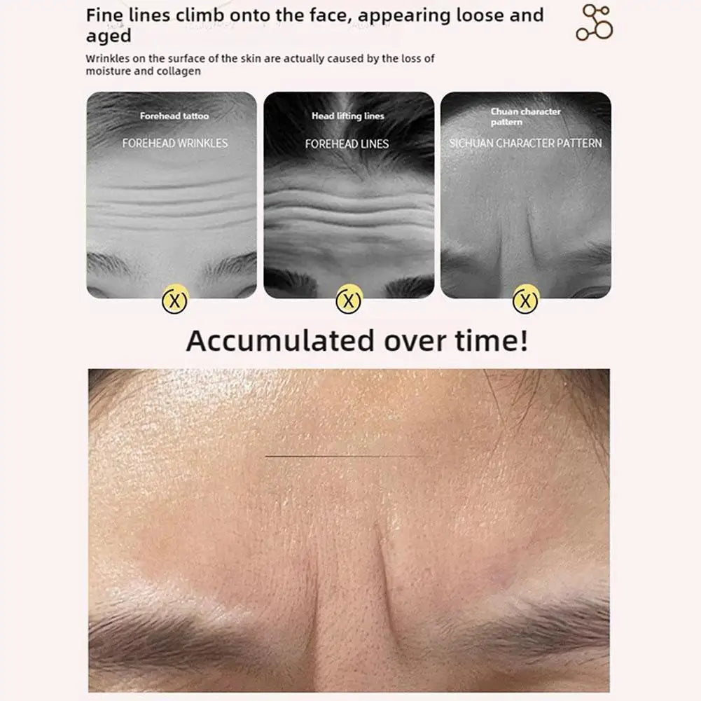 Hyaluronic Acid Forehead Wrinkle Patches – Overnight Smoothing