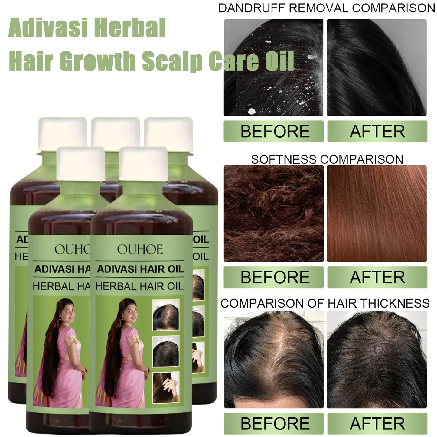 Adivasi Herbal Hair Growth Oil 100ml – Rosemary & Ayurvedic Peaceful Pleasures Health and Wellness