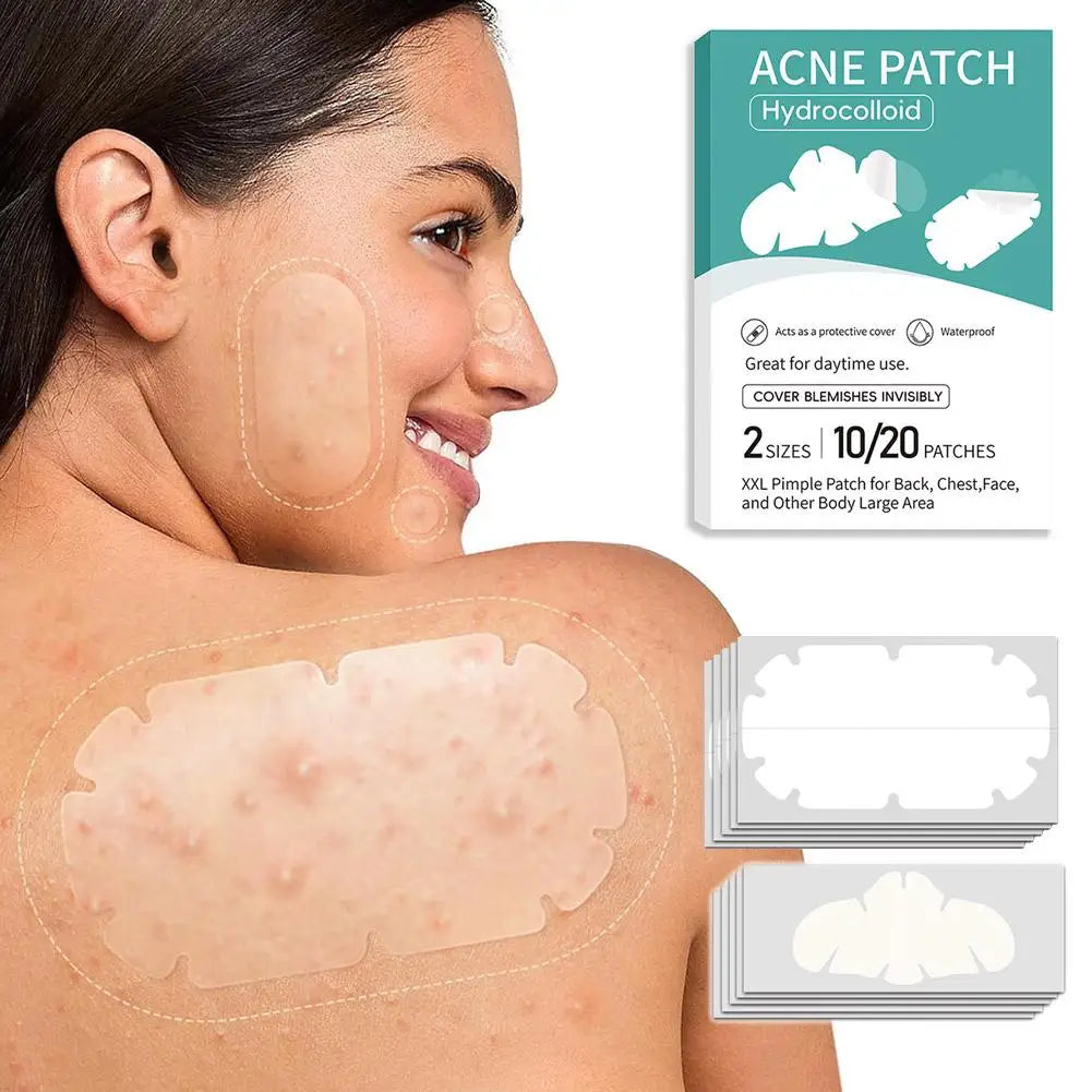 Hydrocolloid Acne Patches – Multi-Shape Invisible Blemish Dots