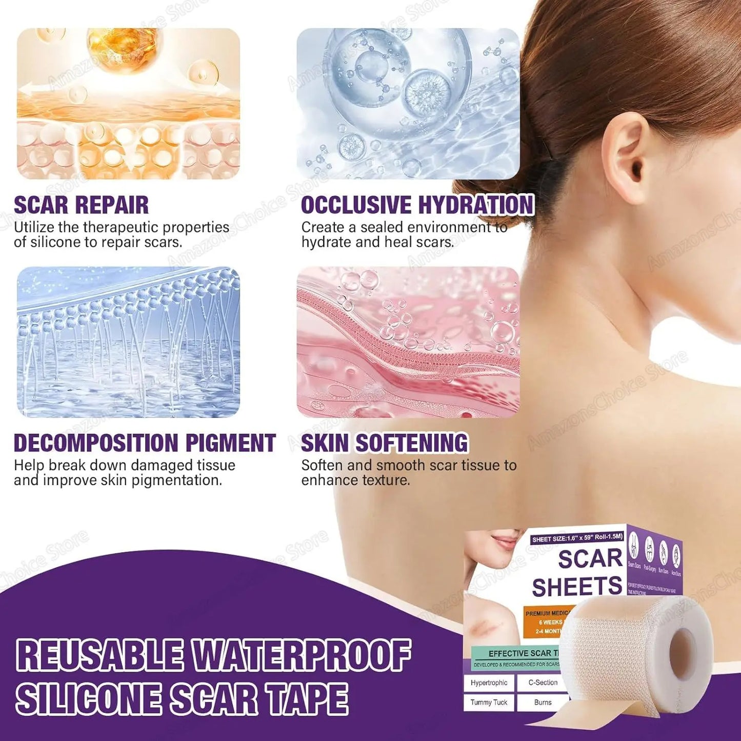 0.5M/1.5M/3M*4cm Silicone Scar Sheets Removal Strips Silicone Gel Scar Strip For Acne Keloid Surgery Burn Treatment Scar Patch Peaceful Pleasures Health and Wellness