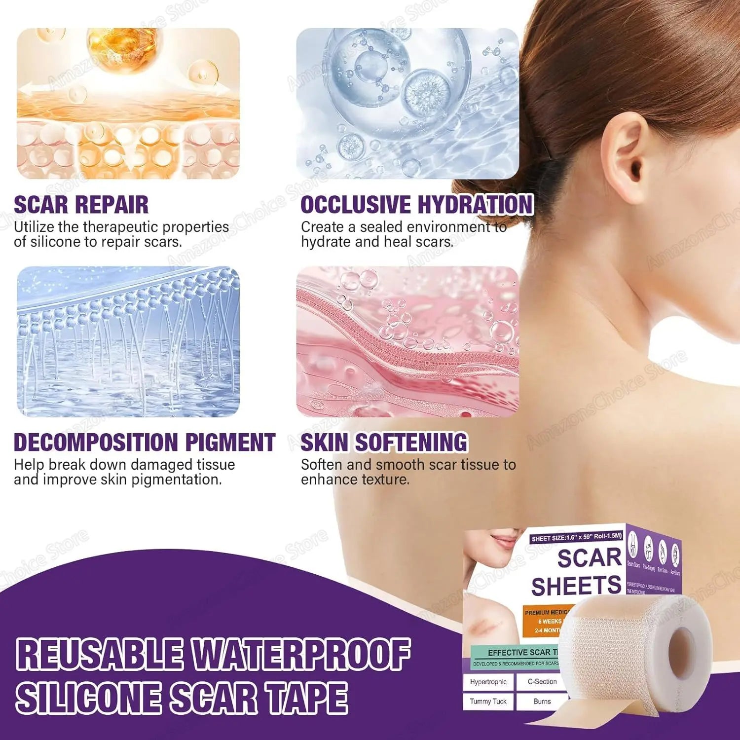 0.5M/1.5M/3M*4cm Silicone Scar Sheets Removal Strips Silicone Gel Scar Strip For Acne Keloid Surgery Burn Treatment Scar Patch Peaceful Pleasures Health and Wellness