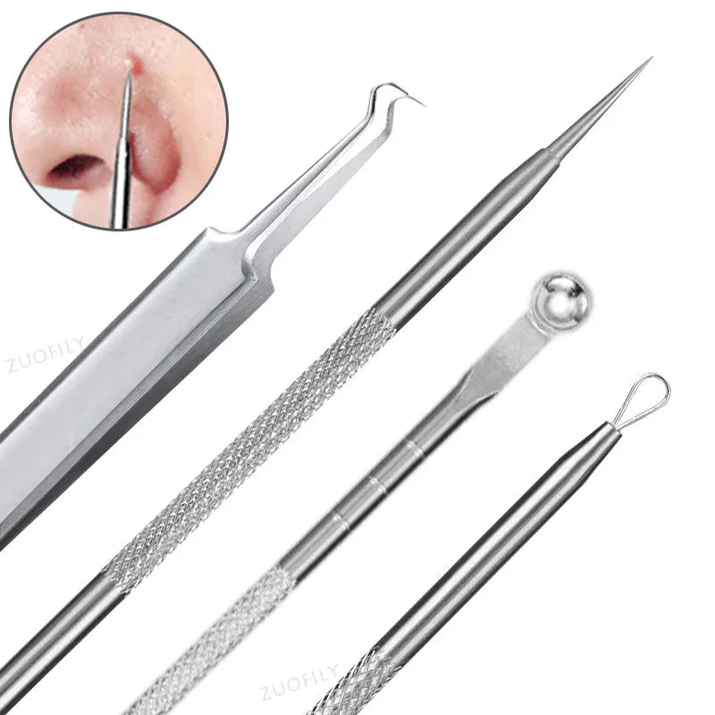 Stainless Steel Blackhead Extractor & Acne Removal Tool