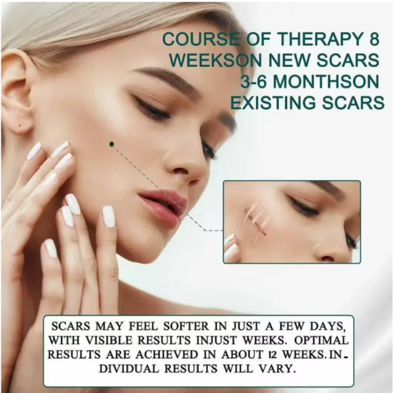 1/2Rolls 4cmx150cm Silicone Scar Sheets Removal Strips Silicone Gel Strip Acne Keloid Surgery Burn Treatment Scar Patch NO B Peaceful Pleasures Health and Wellness