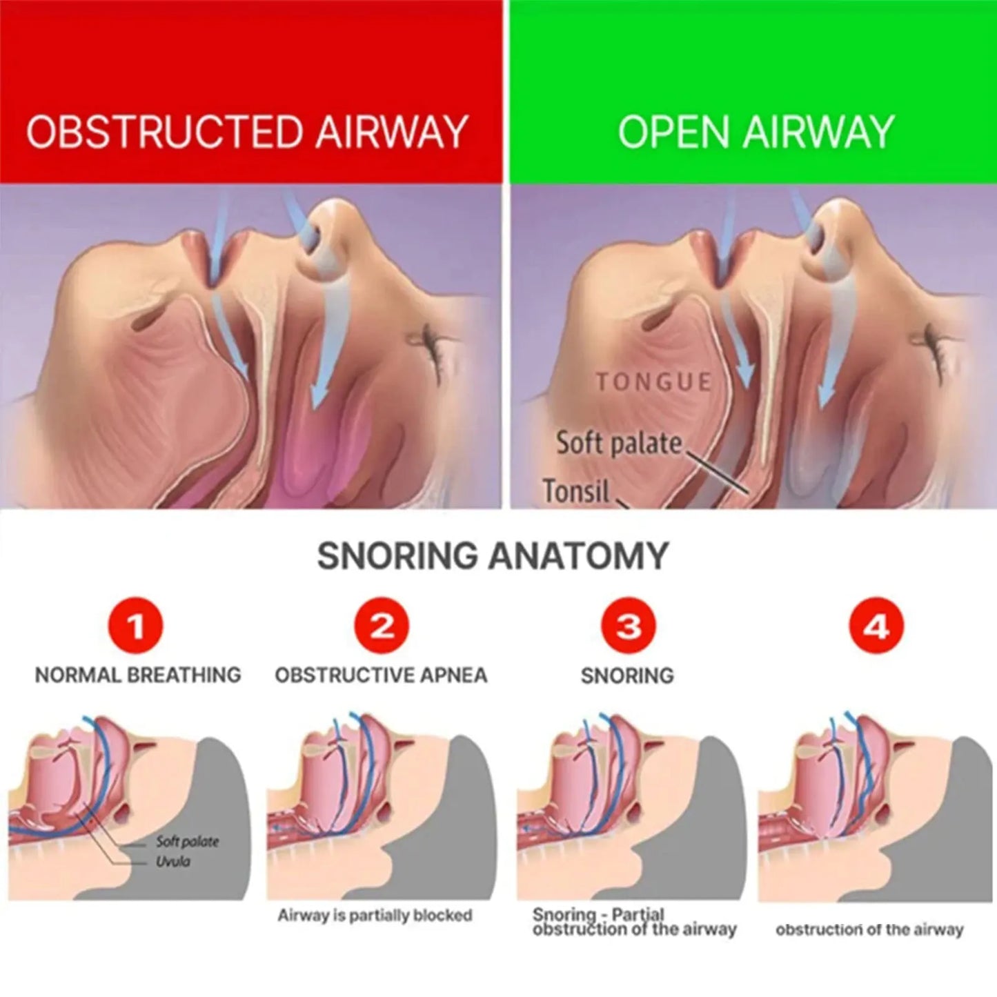 Anti-Snoring & Teeth Grinding Mouthpiece | Sleep Guard