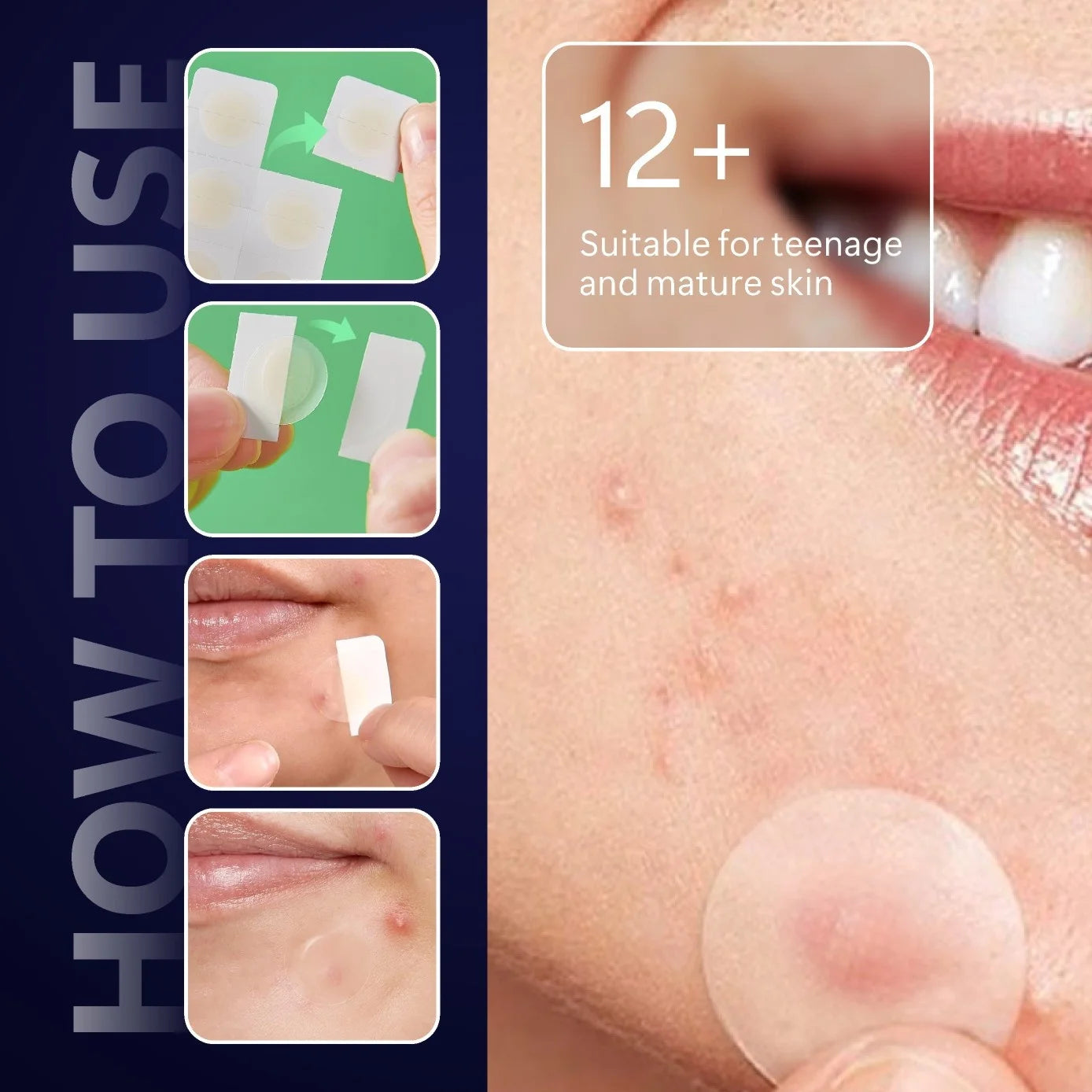 Invisible Waterproof Hydrocolloid Acne Patches – All Skin Types