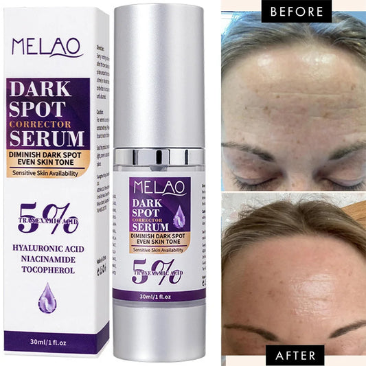 Dark Spot Remover for Face,Dark Spot Corrector Serum for Age Spot Sun Spot Freckles Melasma Brown Spot Skin Care Repair Cream Peaceful Pleasures Health and Wellness