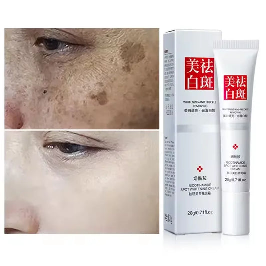 Brightening & Dark Spot Corrector Face Cream – Freckle & Melasma Treatment Face Cream Peaceful Pleasures Health and Wellness