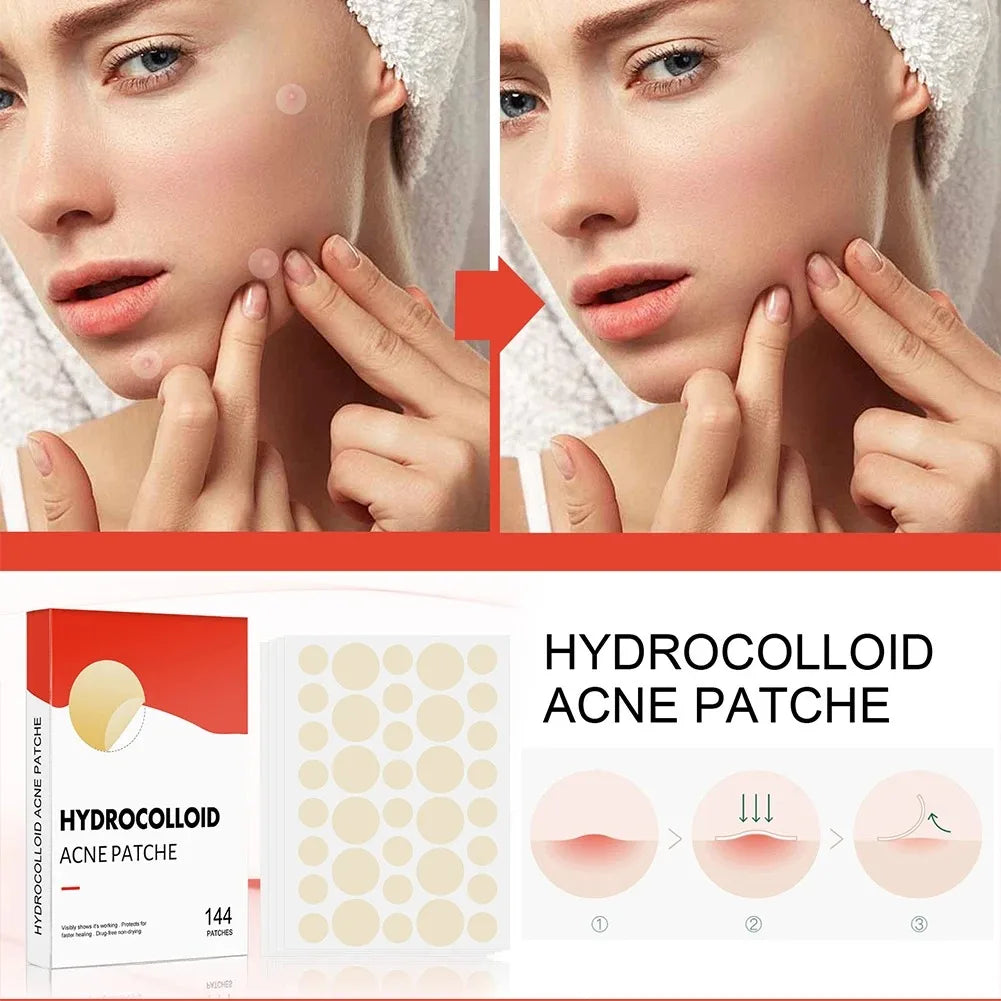 144pcs/set Face High-end Skin Care Pimple Acne Patches Professional Healing Absorbing Spot Sticker Covering for Covering Acne Peaceful Pleasures Health and Wellness